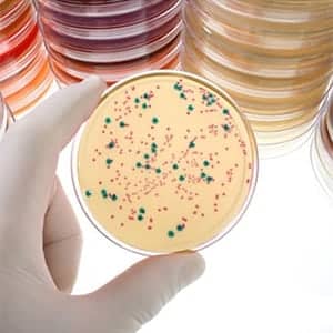 Bacterial Culture Reagents