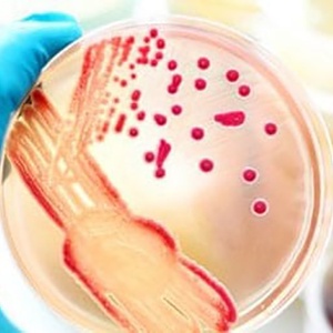Bacterial Culture Reagents